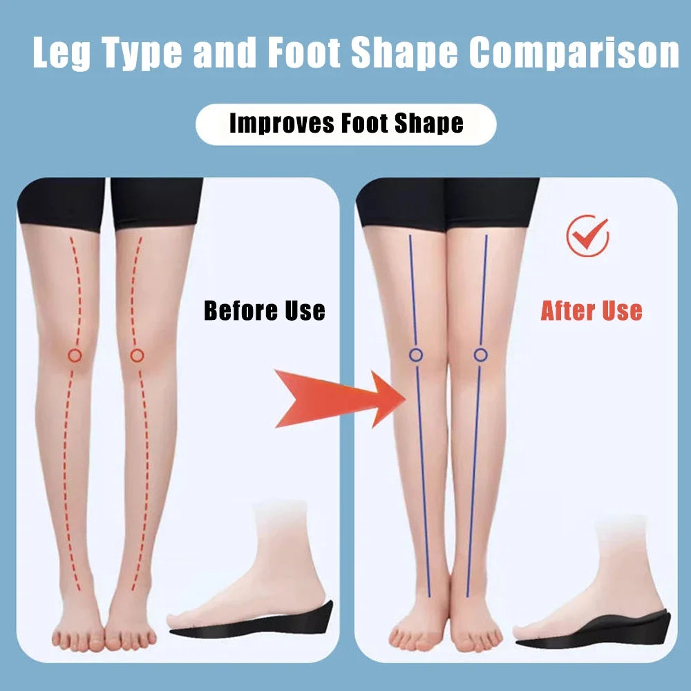 Orthopedic Arch Support Insoles